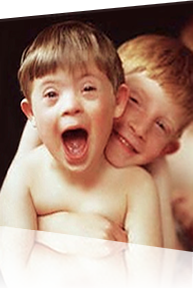 Imagem de duas crianças se abraçando. Uma com Síndrome de Down.